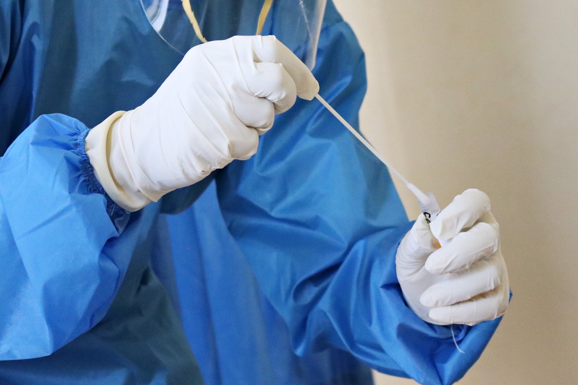 5 Antigentests im Überblick